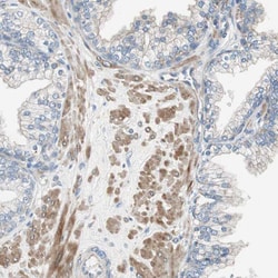 Invitrogen Filamin 2 Polyclonal Antibody 100 &mu;L; Unconjugated:Antibodies,