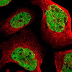 FUBP1 Polyclonal Antibody:Antibodies, Polyclonal