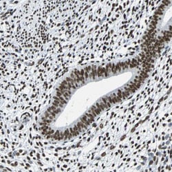 FUBP1 Polyclonal Antibody:Antibodies, Polyclonal