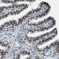 FUBP1 Polyclonal Antibody:Antibodies, Polyclonal