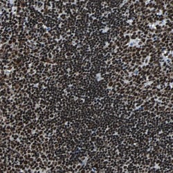 FUBP1 Polyclonal Antibody:Antibodies, Polyclonal