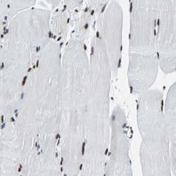 FUBP1 Polyclonal Antibody:Antibodies, Polyclonal