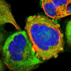 Invitrogen TSG101 Polyclonal Antibody 100 &mu;L; Unconjugated:Antibodies,