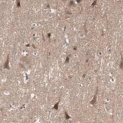 Invitrogen TSG101 Polyclonal Antibody 100 &mu;L; Unconjugated:Antibodies,