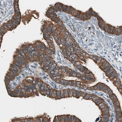 Invitrogen TSG101 Polyclonal Antibody 100 &mu;L; Unconjugated:Antibodies,