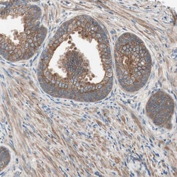 Invitrogen TSG101 Polyclonal Antibody 100 &mu;L; Unconjugated:Antibodies,