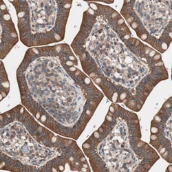 Invitrogen TSG101 Polyclonal Antibody 100 &mu;L; Unconjugated:Antibodies,