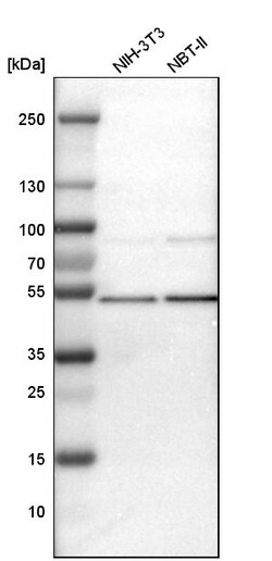 Invitrogen TSG101 Polyclonal Antibody 100 &mu;L; Unconjugated:Antibodies