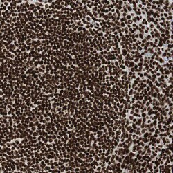 Invitrogen MTA2 Polyclonal Antibody 100 &mu;L; Unconjugated:Antibodies,