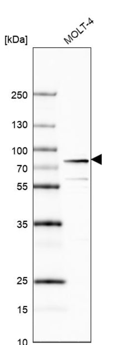 Invitrogen MTA2 Polyclonal Antibody 100 &mu;L; Unconjugated:Antibodies,