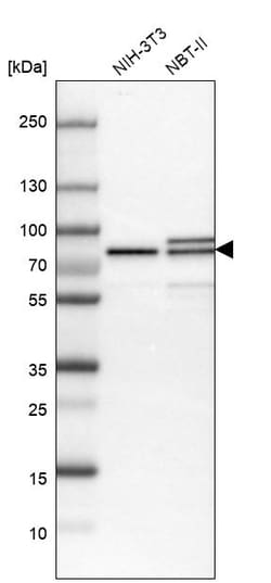 Invitrogen MTA2 Polyclonal Antibody 100 &mu;L; Unconjugated:Antibodies,