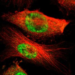 MED4 Polyclonal Antibody:Antibodies, Polyclonal