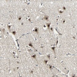 MED4 Polyclonal Antibody:Antibodies, Polyclonal