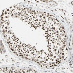 MED4 Polyclonal Antibody:Antibodies, Polyclonal