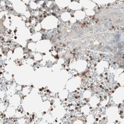 Invitrogen USP20 Polyclonal Antibody 100 &mu;L; Unconjugated:Antibodies,