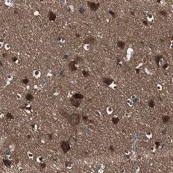 Invitrogen HPRT1 Polyclonal Antibody 100 &mu;L; Unconjugated:Antibodies,