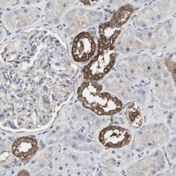 Invitrogen HPRT1 Polyclonal Antibody 100 &mu;L; Unconjugated:Antibodies,