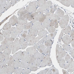 Invitrogen HPRT1 Polyclonal Antibody 100 &mu;L; Unconjugated:Antibodies,