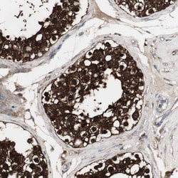 Invitrogen HPRT1 Polyclonal Antibody 100 &mu;L; Unconjugated:Antibodies,