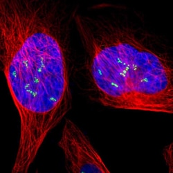 UBF-1 Polyclonal Antibody:Antibodies, Polyclonal