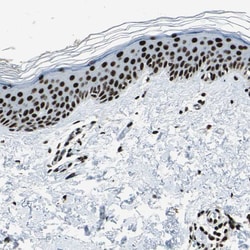UBF-1 Polyclonal Antibody:Antibodies, Polyclonal