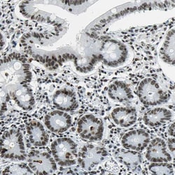 UBF-1 Polyclonal Antibody:Antibodies, Polyclonal
