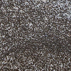 UBF-1 Polyclonal Antibody:Antibodies, Polyclonal
