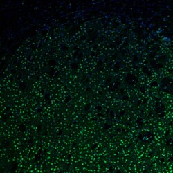 UBF-1 Polyclonal Antibody:Antibodies, Polyclonal