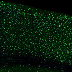 UBF-1 Polyclonal Antibody:Antibodies, Polyclonal