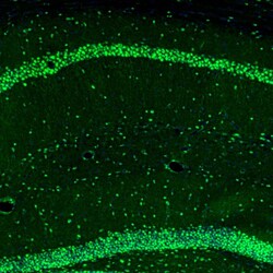 UBF-1 Polyclonal Antibody:Antibodies, Polyclonal