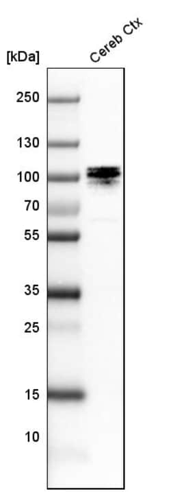 Invitrogen UBF-1 Polyclonal Antibody 100 &mu;L; Unconjugated:Anticorps,