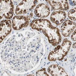 Invitrogen ALDH4A1 Polyclonal Antibody 100 &mu;L; Unconjugated:Antibodies,
