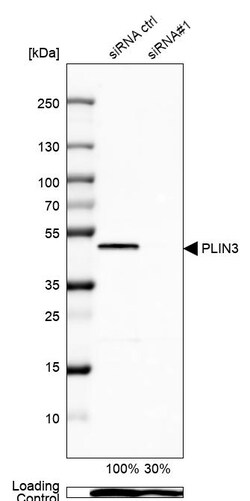 Invitrogen TIP47 Polyclonal Antibody 100 &mu;L | Buy Online | Invitrogen&trade; | Fisher Scientific