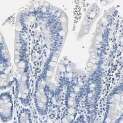 Invitrogen Carbonic Anhydrase I Polyclonal Antibody 100 &mu;L; Unconjugated:Antibodies,