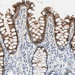 Invitrogen Carbonic Anhydrase I Polyclonal Antibody 100 &mu;L; Unconjugated:Antibodies,