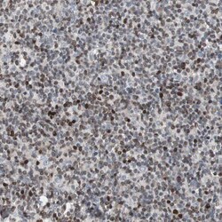 ZNF396 Polyclonal Antibody:Antibodies, Polyclonal