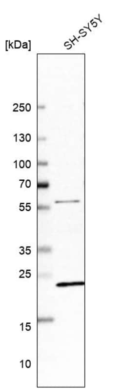 Invitrogen ZNF396 Polyclonal Antibody 100 &mu;L; Unconjugated:Antibodies,