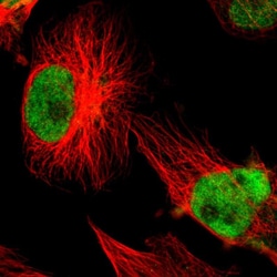 XRCC1 Polyclonal Antibody:Antibodies, Polyclonal