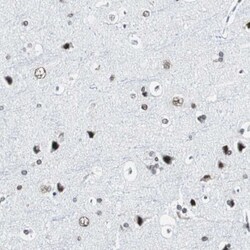 XRCC1 Polyclonal Antibody:Antibodies, Polyclonal