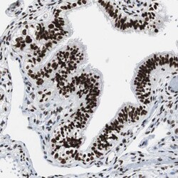 XRCC1 Polyclonal Antibody:Antibodies, Polyclonal