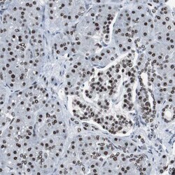 XRCC1 Polyclonal Antibody:Antibodies, Polyclonal