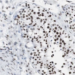 XRCC1 Polyclonal Antibody:Antibodies, Polyclonal