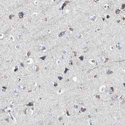 Invitrogen ACAA1 Polyclonal Antibody 100 &mu;L; Unconjugated:Antibodies,