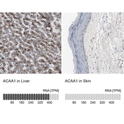 Invitrogen ACAA1 Polyclonal Antibody 100 &mu;L; Unconjugated:Antibodies,