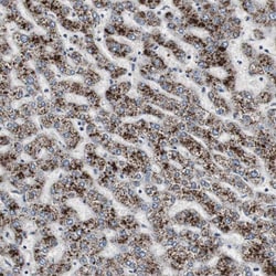 Invitrogen ACAA1 Polyclonal Antibody 100 &mu;L; Unconjugated:Antibodies,