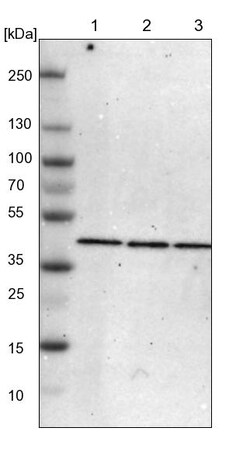 Invitrogen ACAA1 Polyclonal Antibody 100 &mu;L; Unconjugated:Antibodies,