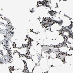 Invitrogen PNK Polyclonal Antibody 100 &mu;L; Unconjugated:Antibodies,