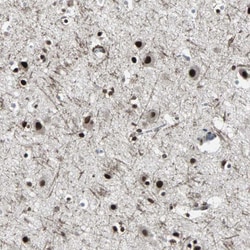Invitrogen PNK Polyclonal Antibody 100 &mu;L; Unconjugated:Antibodies,