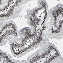 Invitrogen PNK Polyclonal Antibody 100 &mu;L; Unconjugated:Antibodies,