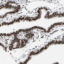 Invitrogen PNK Polyclonal Antibody 100 &mu;L; Unconjugated:Antibodies,